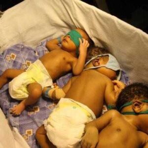 Aider une mère de triplé et célibataire- exemple